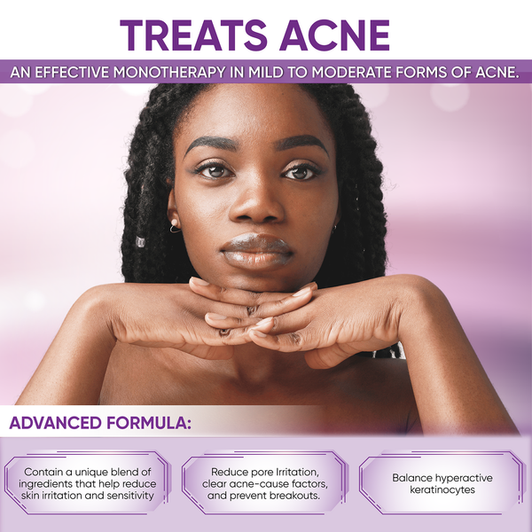 aobbiy glutathione dark spot corrector AOBBIY Hyperpigmentation Treatment â€“ Dark Spot Remover for Face & Body,  Niacinamide Serum for Melasma, Sun Spots, 1.01 Fl Oz | Buy Now with Express  International Delivery main image 1